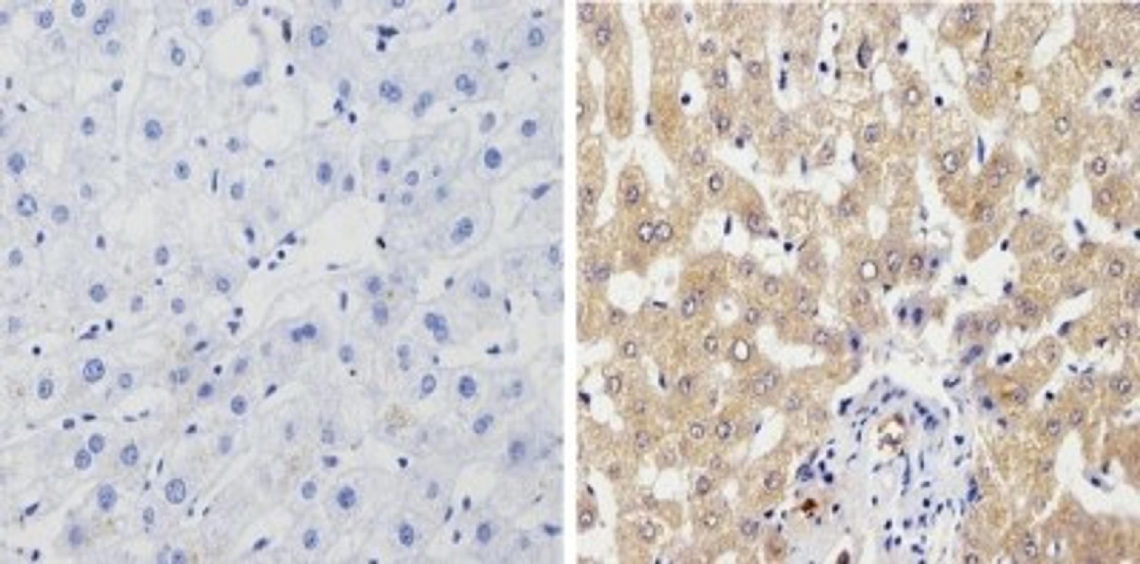 Immunohistochemistry-Paraffin: Cytochrome P450 1A1/1A2 Antibody (MC1) [NB100-74398] - Analysis showing positive staining in the cytoplasm and membrane of Human liver tissue (right) compared with a negative control in the absence of primary antibody (left).