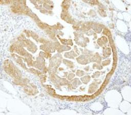 Detection of human PABP4 by immunohistochemistry.