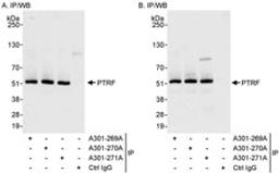 Detection of human PTRF by western blot of immunoprecipitates.