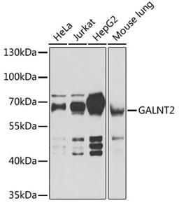 Western blot - GALNT2 antibody (A6910)