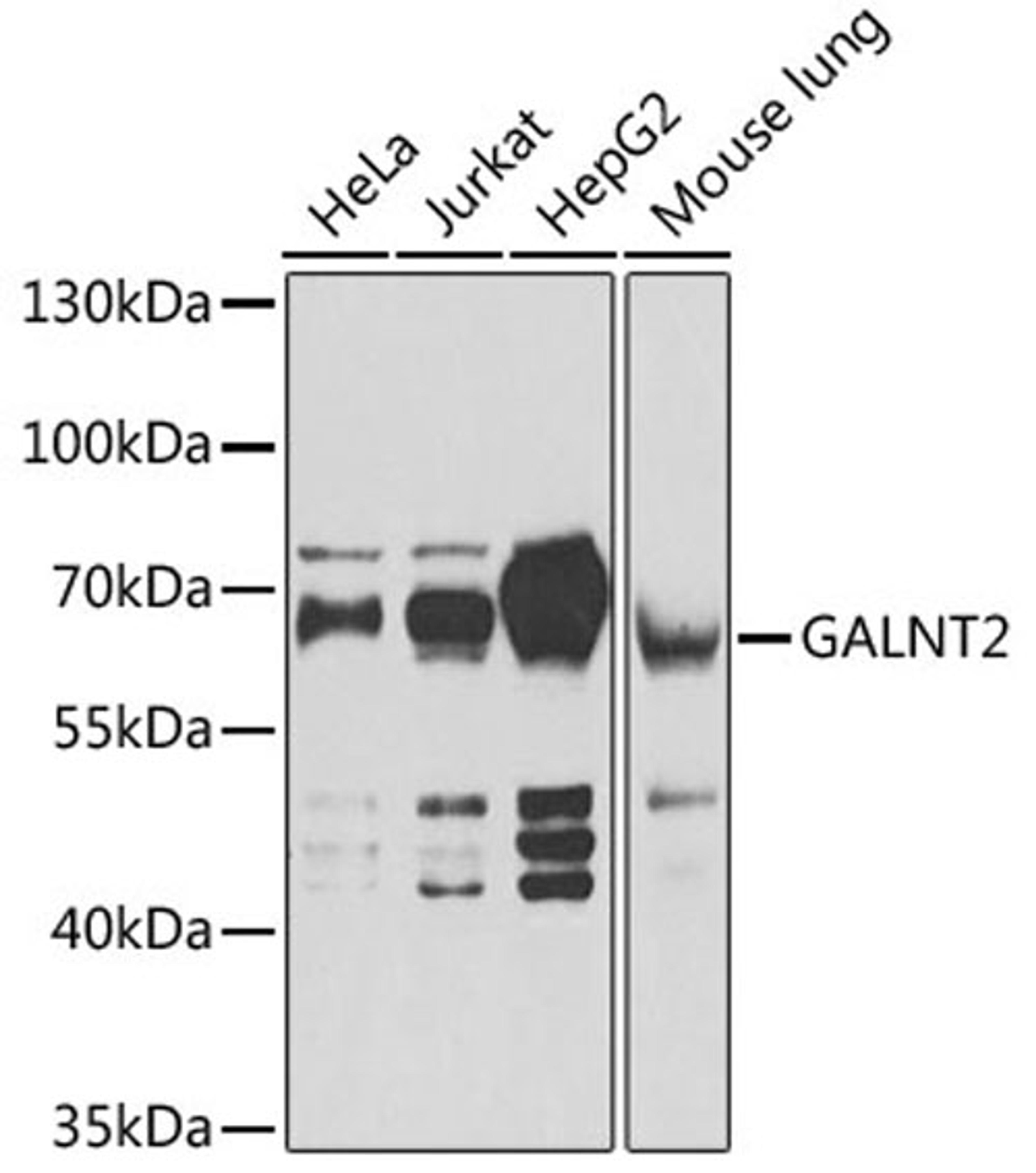 Western blot - GALNT2 antibody (A6910)