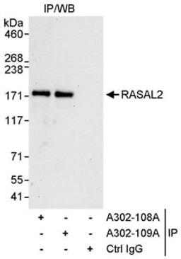 Detection of human RASAL2 by western blot of immunoprecipitates.