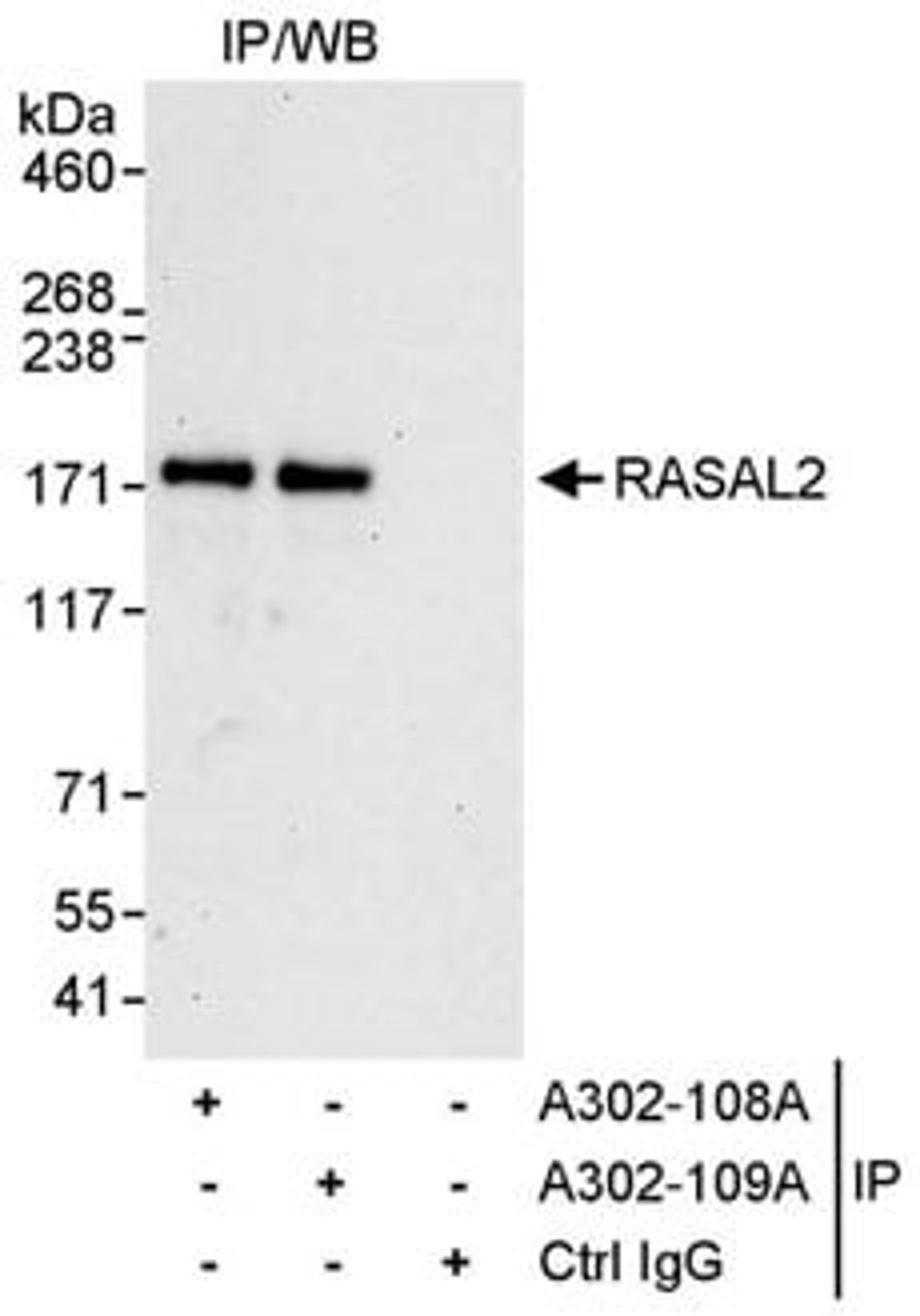 Detection of human RASAL2 by western blot of immunoprecipitates.