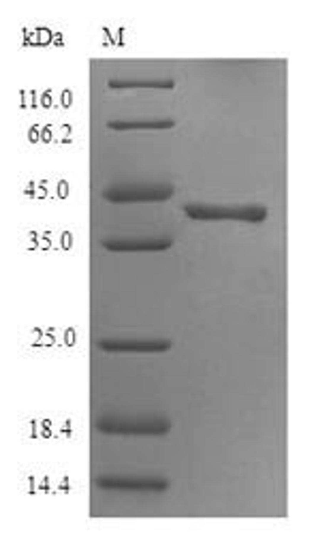 (Tris-Glycine gel) Discontinuous SDS-PAGE (reduced) with 5% enrichment gel and 15% separation gel.