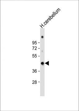 Western Blot at 1:1000 dilution + human cerebellum lysate Lysates/proteins at 20 ug per lane.