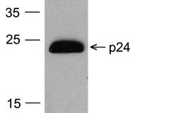 Western blot analysis of 20 ng of HIV-1 p24 protein with PM-6585-HRP at 0.2 μg/mL.
