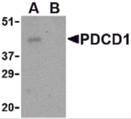 Western blot analysis of PD-1 in THP-1 cell lysate with PD-1 antibody at 1 μg/mL in the (A) absence and (B) presence of blocking peptide.