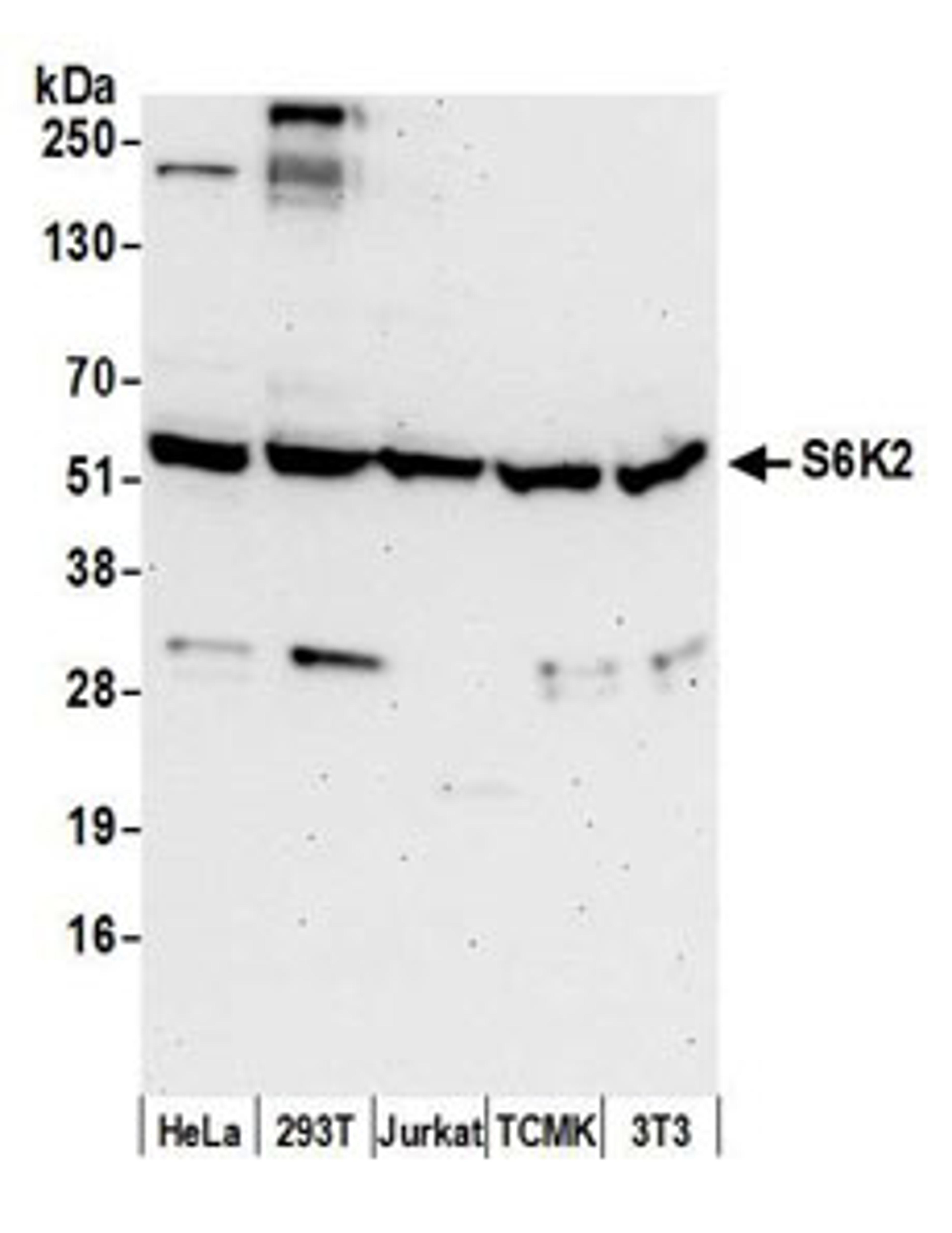 Detection of human and mouse S6K2 by western blot.