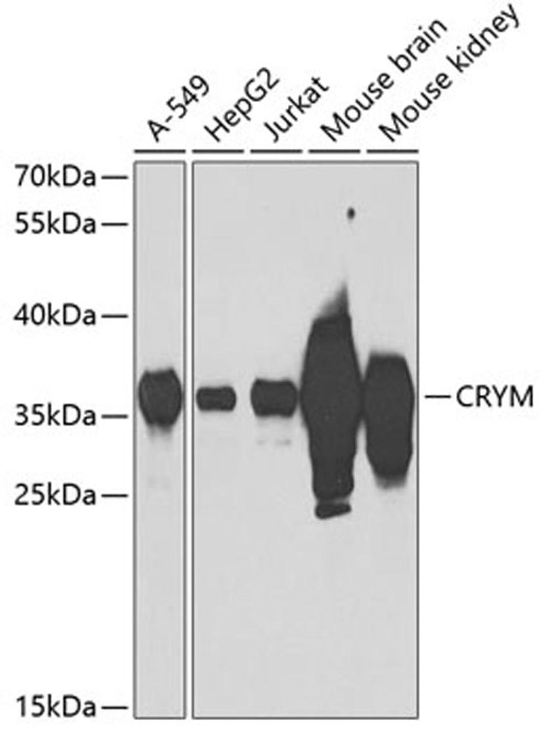 Western blot - CRYM antibody (A3810)