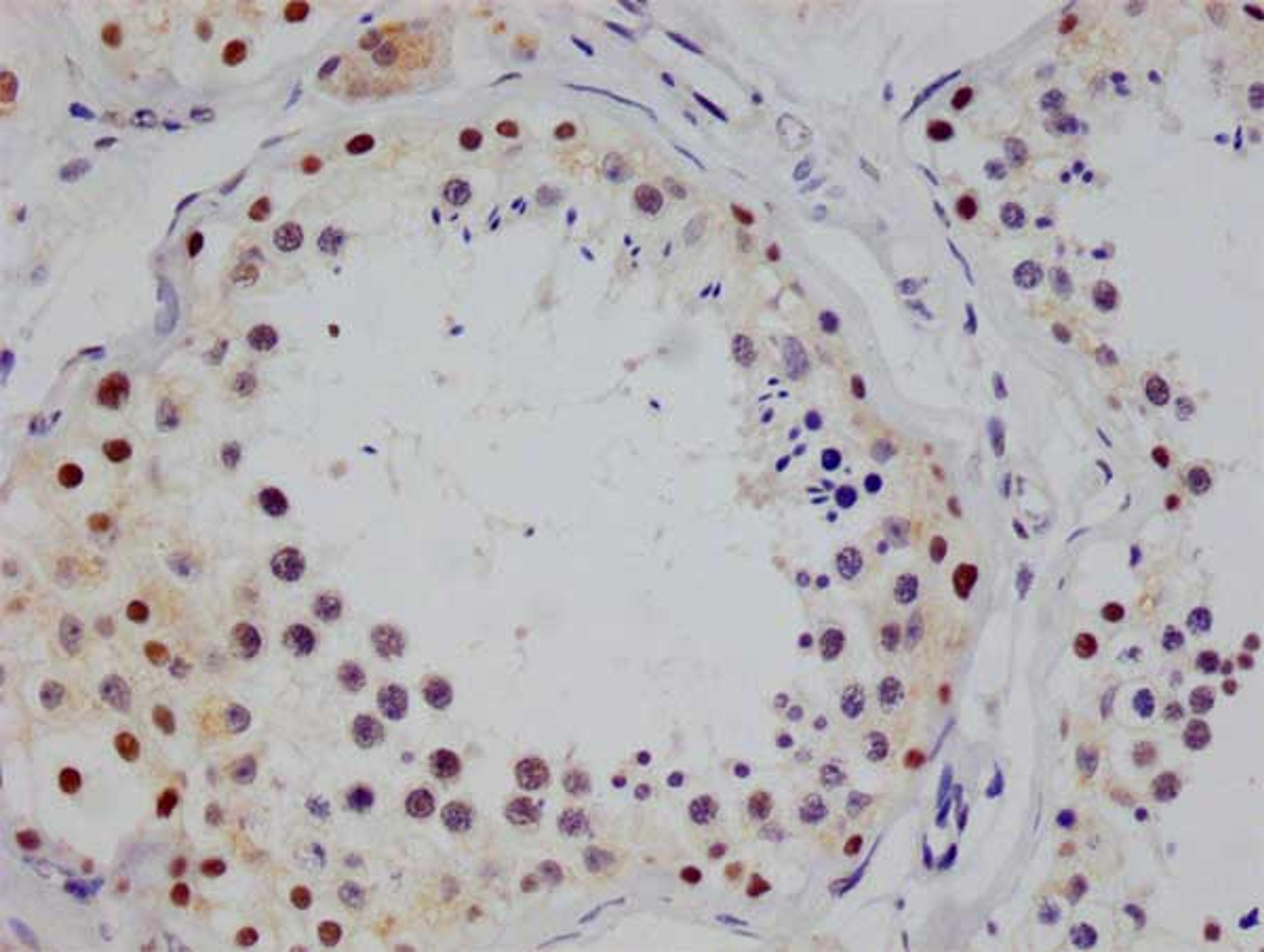 IHC image of CSB-RA547973A0HU diluted at 1:100 and staining in paraffin-embedded human testis tissue performed on a Leica BondTM system. After dewaxing and hydration, antigen retrieval was mediated by high pressure in a citrate buffer (pH 6.0). Section was blocked with 10% normal goat serum 30min at RT. Then primary antibody (1% BSA) was incubated at 4°C overnight. The primary is detected by a Goat anti-rabbit polymer IgG labeled by HRP and visualized using 0.05% DAB.