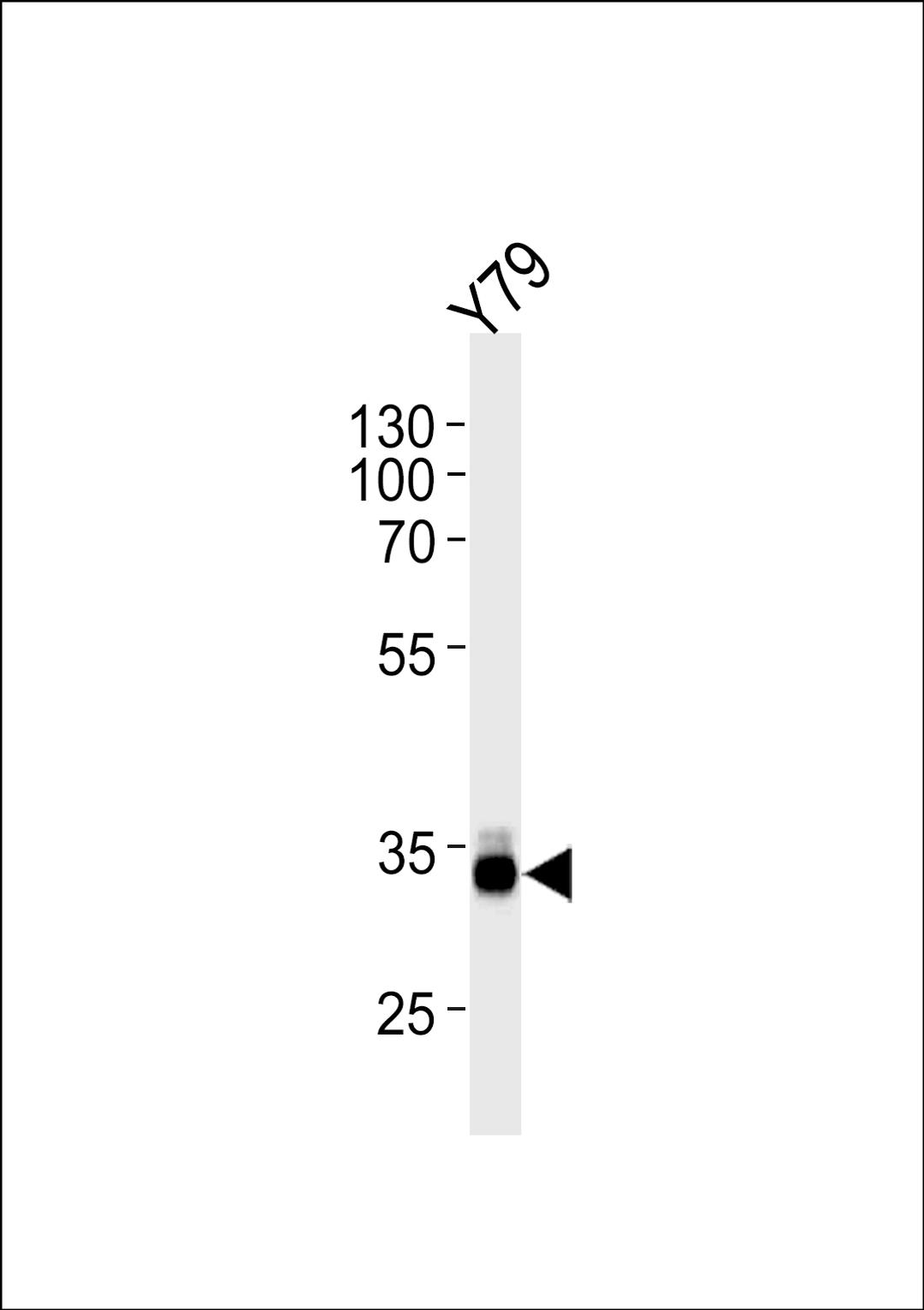 Western blot analysis in Y79 cell line lysates (35ug/lane).