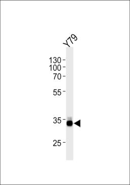 Western blot analysis in Y79 cell line lysates (35ug/lane).