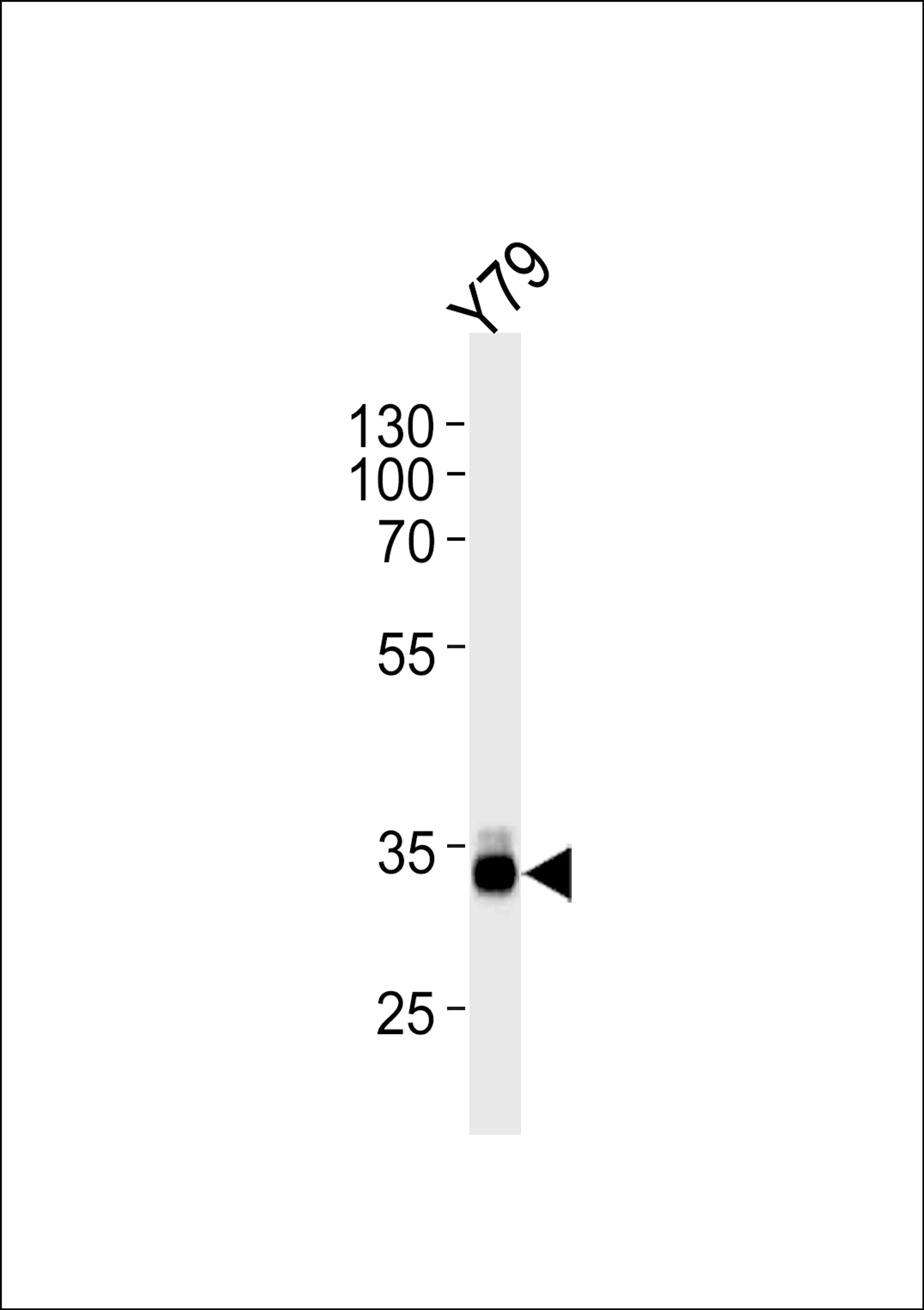 Western blot analysis in Y79 cell line lysates (35ug/lane).