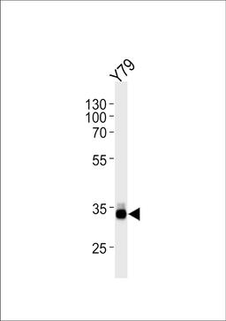 Western blot analysis in Y79 cell line lysates (35ug/lane).