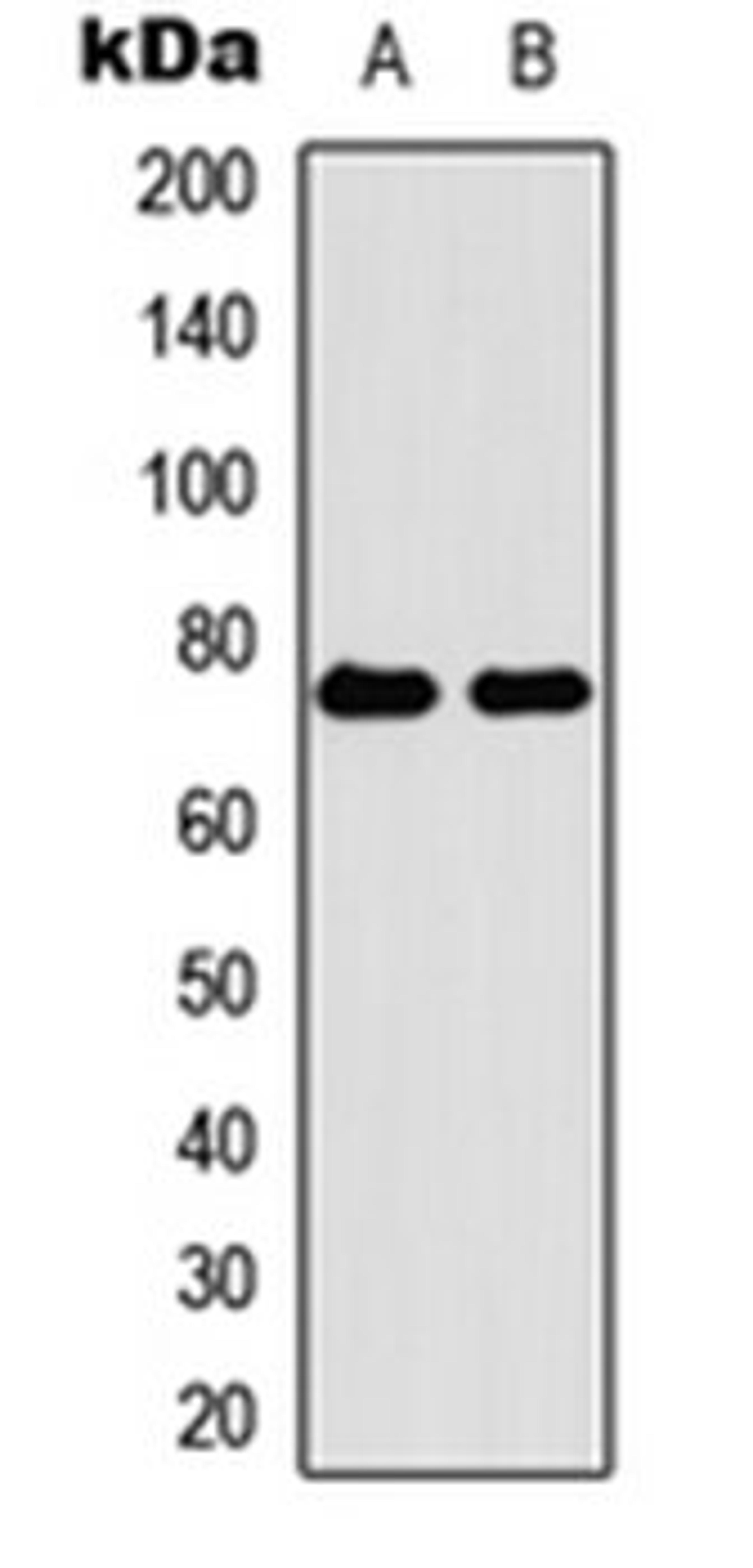 Western blot analysis of HEK293T (Lane 1), H9C2 (Lane 2) whole cell lysates using FILTRIN antibody