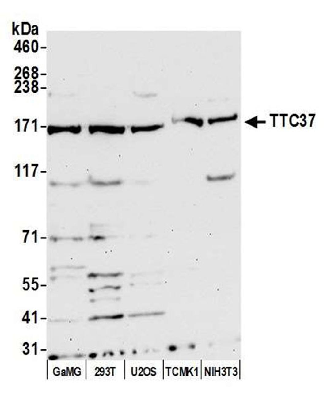 Detection of human and mouse TTC37 by WB.