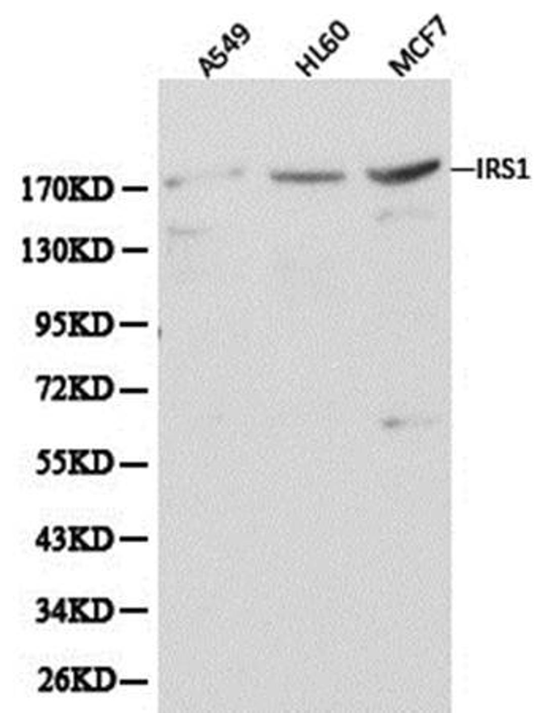 Western blot analysis of extracts of various cell line lysates using IRS-1  antibody