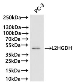 Western blot. All lanes: L2HGDH antibody at 4.43 ug/ml + Mouse heart tissue. Secondary. Goat polyclonal to rabbit IgG at 1/10000 dilution. Predicted band size: 51, 49 kDa. Observed band size: 51 kDa. 