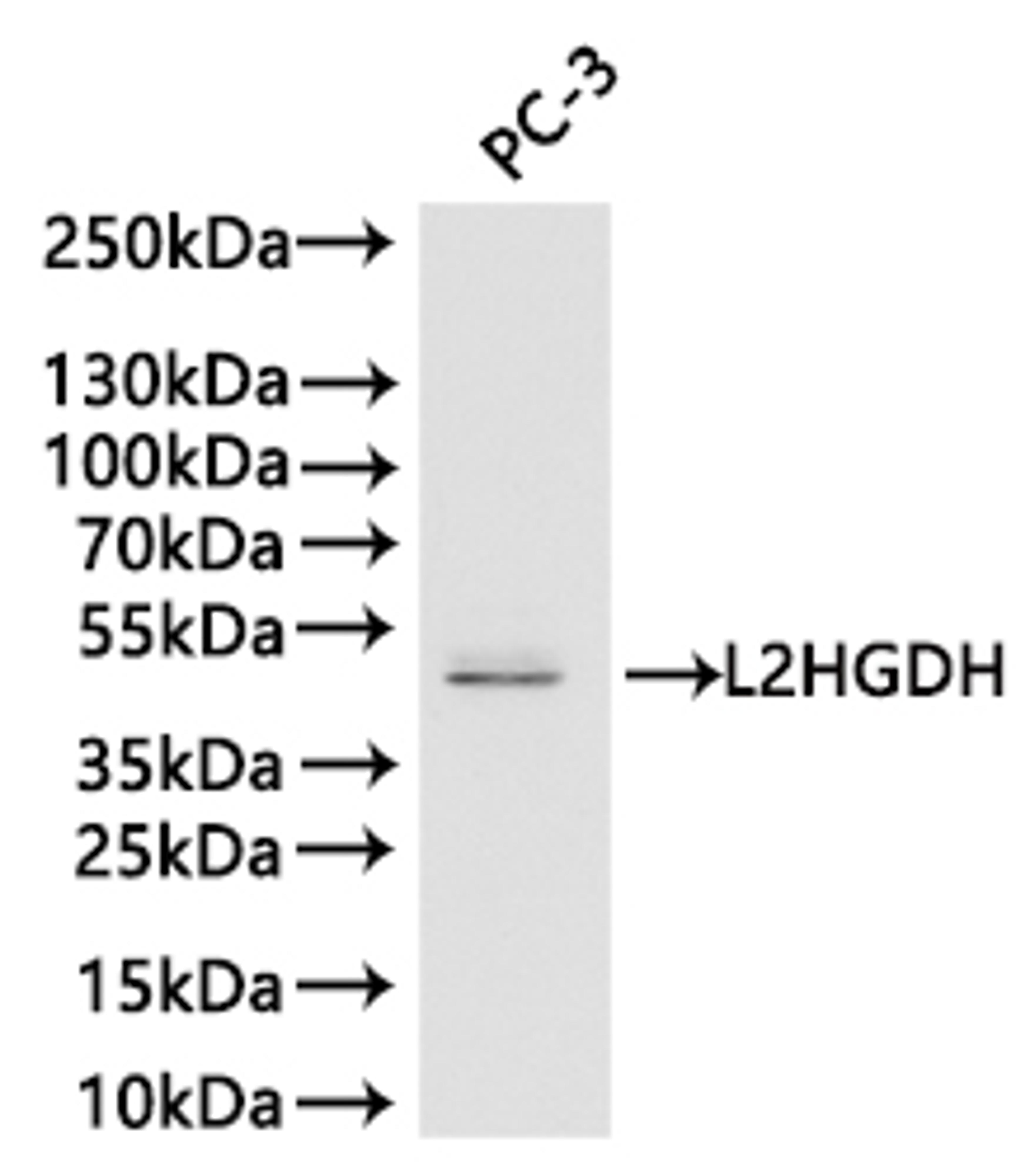 Western blot. All lanes: L2HGDH antibody at 4.43 ug/ml + Mouse heart tissue. Secondary. Goat polyclonal to rabbit IgG at 1/10000 dilution. Predicted band size: 51, 49 kDa. Observed band size: 51 kDa. 