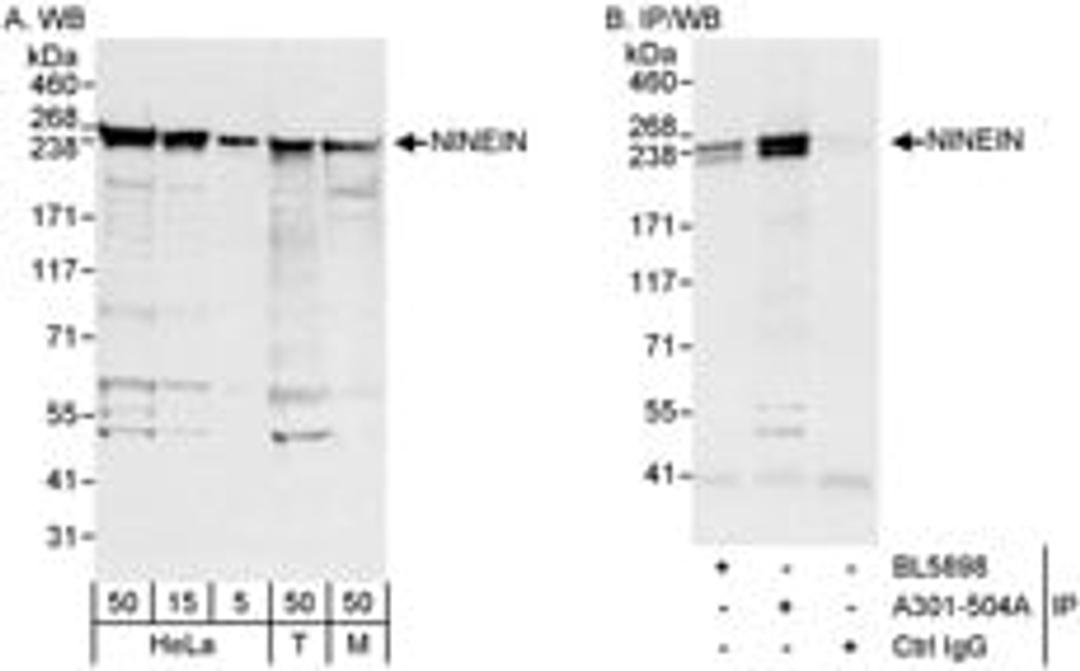 Detection of human and mouse NINEIN by western blot (h&m) and immunoprecipitation (h).