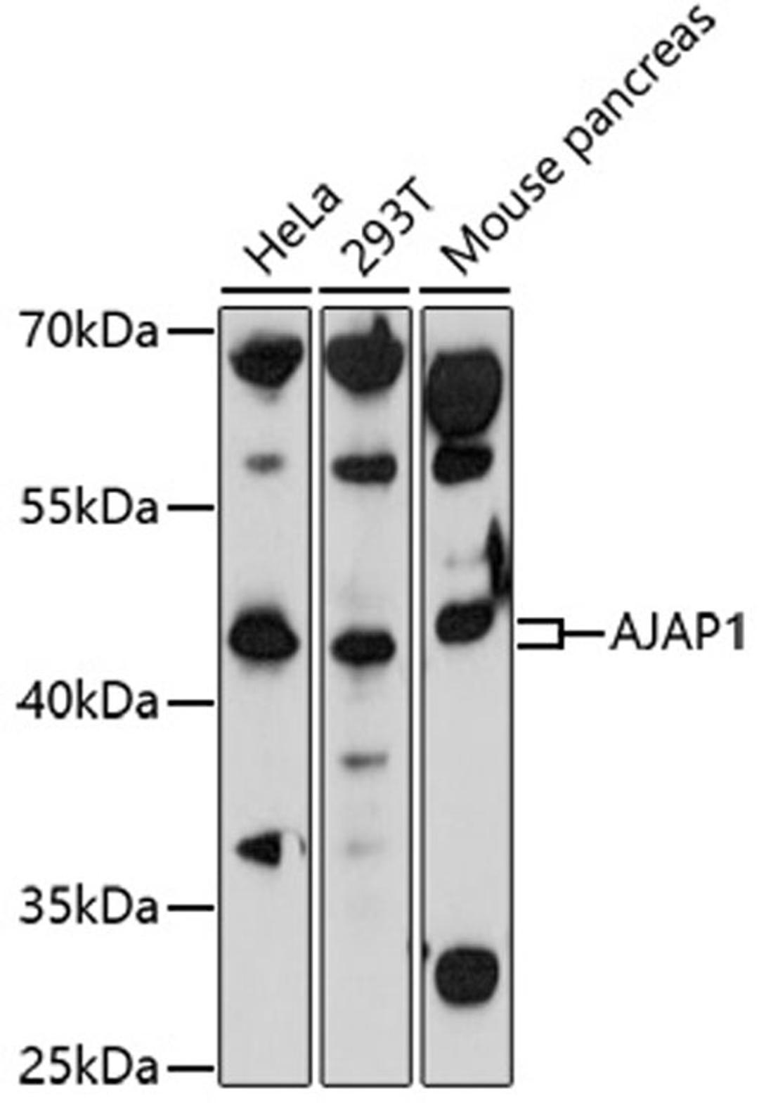 Western blot - AJAP1 antibody (A17184)