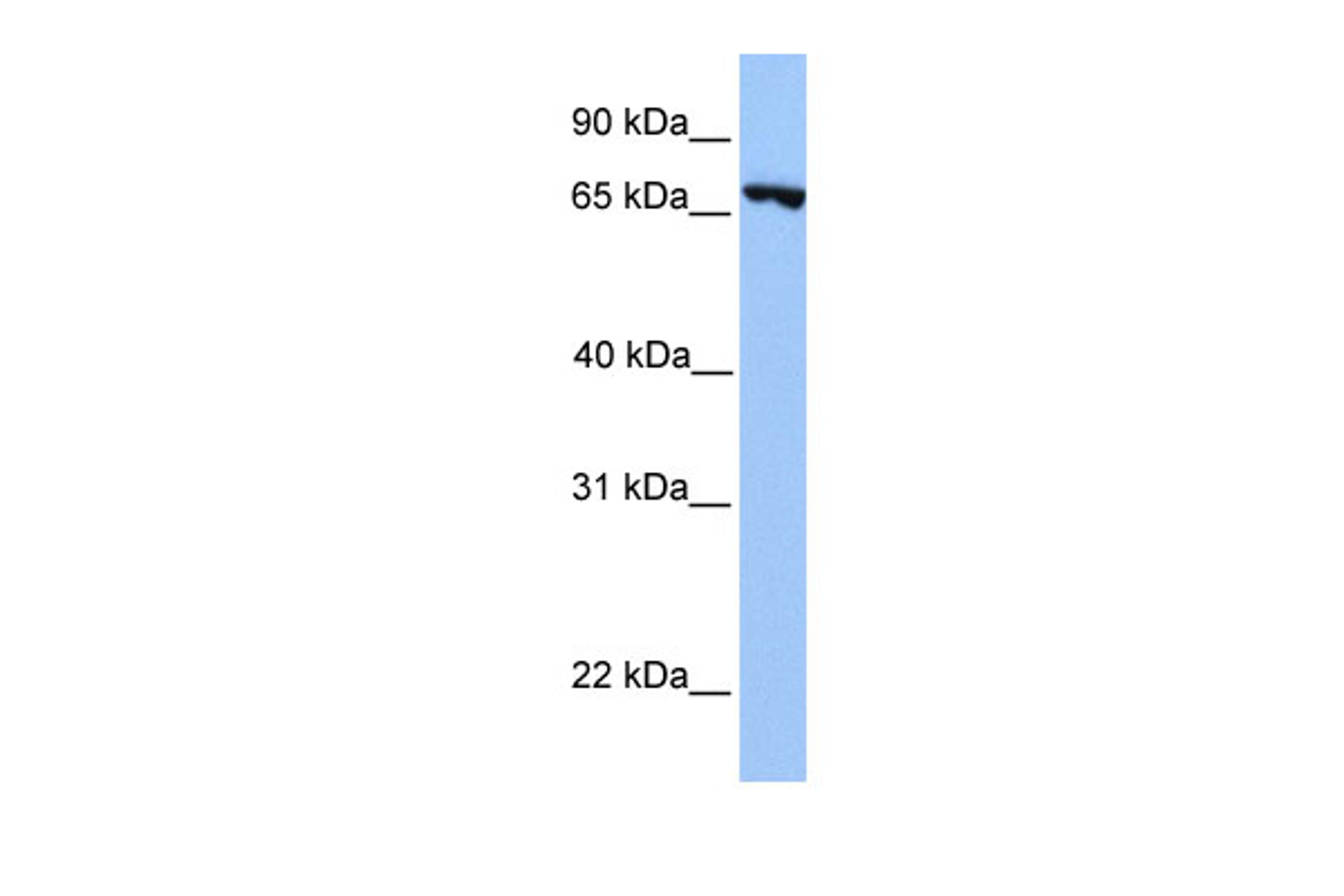 Antibody used in WB on Human Jurkat 0.2-1 ug/ml.