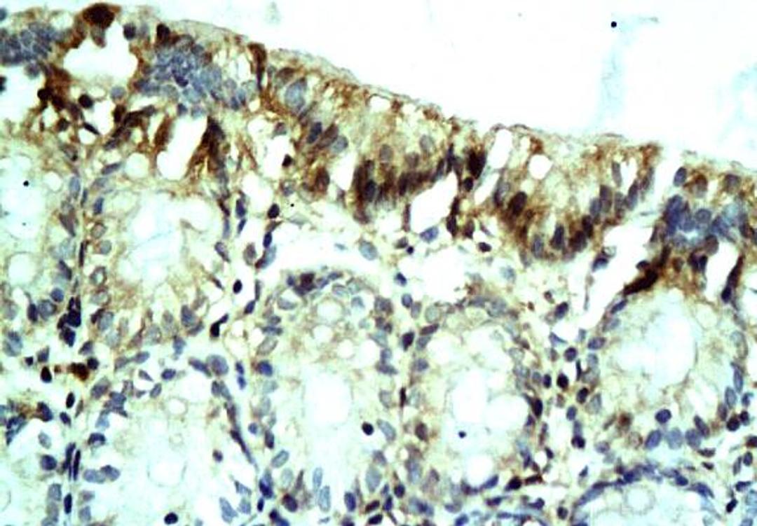 Immunohistochemical analysis of paraffin-embedded colon tissues of rats using Resistin antibody 