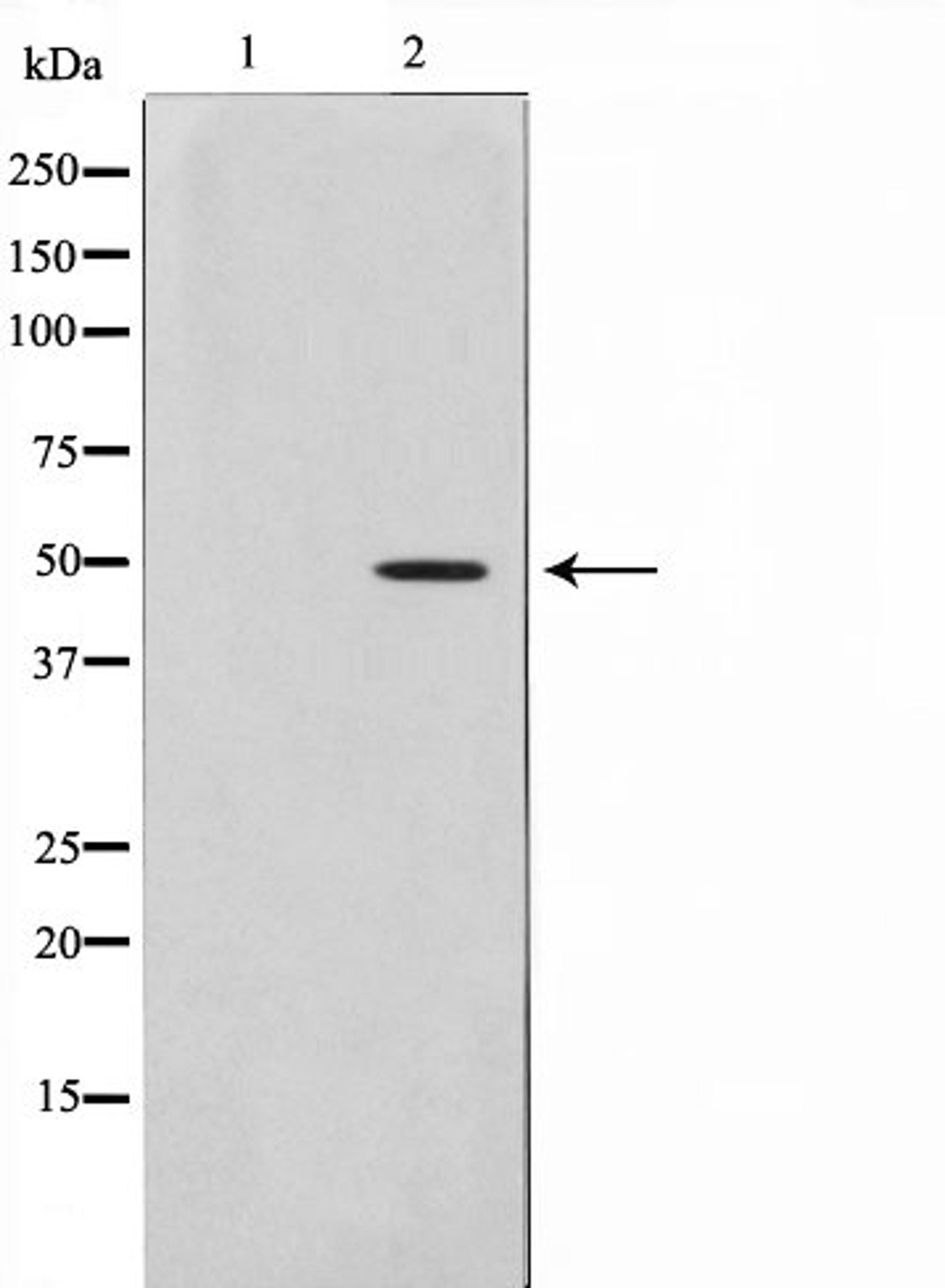 Western blot analysis of Jurkat cell lysate using PLCH antibody