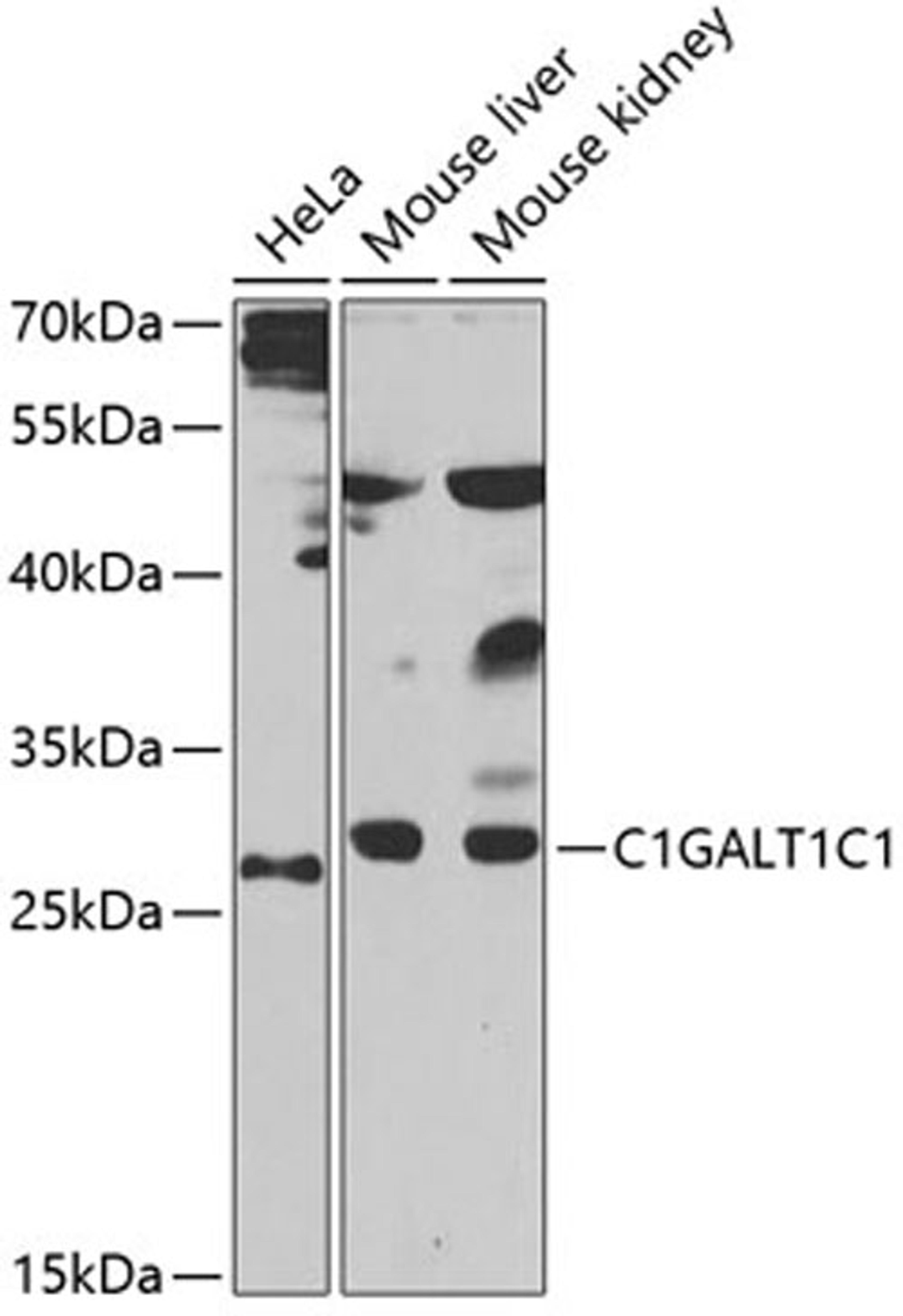 Western blot - C1GALT1C1 antibody (A7590)