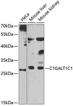 Western blot - C1GALT1C1 antibody (A7590)