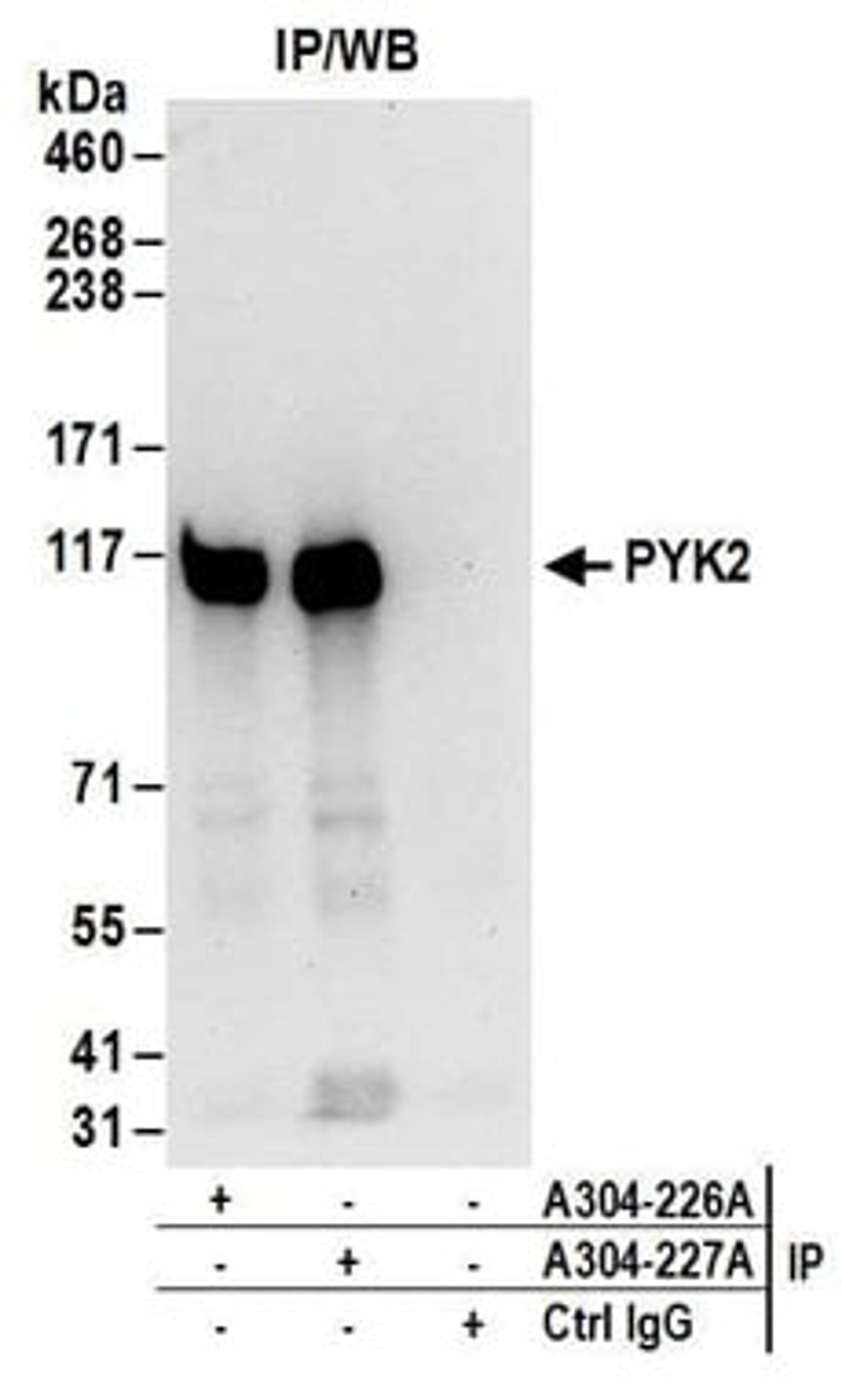 Detection of human PYK2 by western blot of immunoprecipitates.