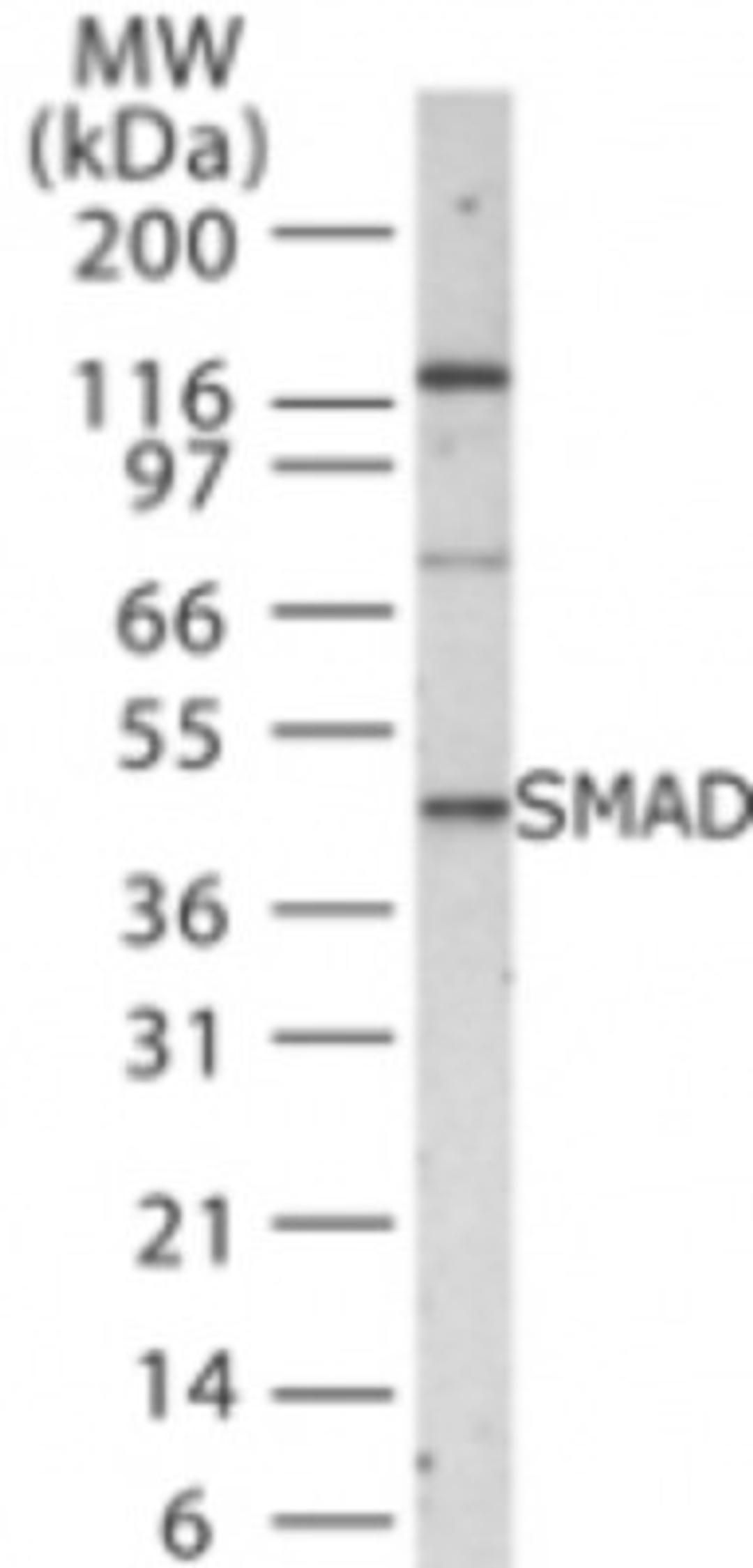 Western Blot: SMAD1/5/8/9 Antibody [NB100-56656] - analysis using SMAD antibody. Lysate from Saos-2 cells probed with SMAD antibody at 1:1000.