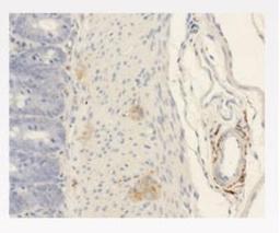 Immunohistochemistry-Paraffin: CGRP1 Antibody (5) [NBP1-05164] - Paraffin embedded rat tissue stained with NBP1-05164 Anti- alpha CGRP diluted 1:400 in 1% BSA/PBS and incubated over night.