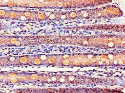 Immunohistochemistry of paraffin-embedded human small intestine tissue using CSB-PA012025LA01HU at dilution of 1:100
