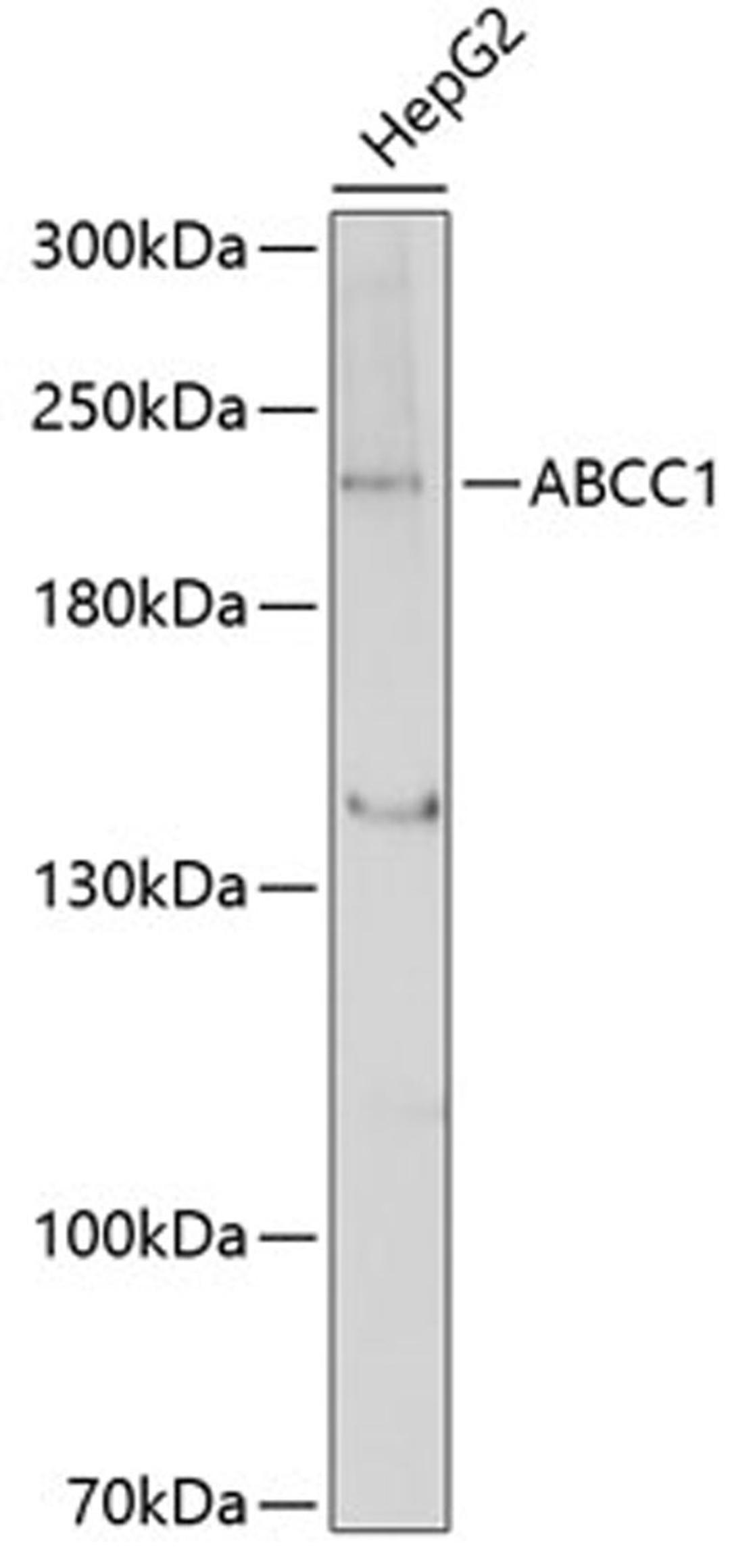 Western blot - ABCC1 antibody (A11153)