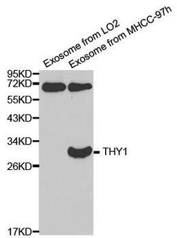 Western blot analysis of extracts of exosome from various cell lines using THY1 antibody