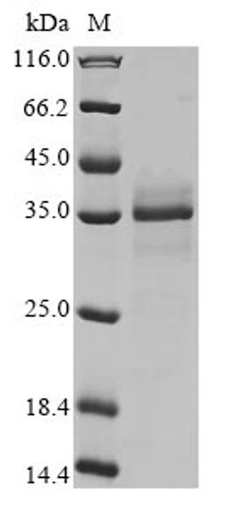 (Tris-Glycine gel) Discontinuous SDS-PAGE (reduced) with 5% enrichment gel and 15% separation gel.