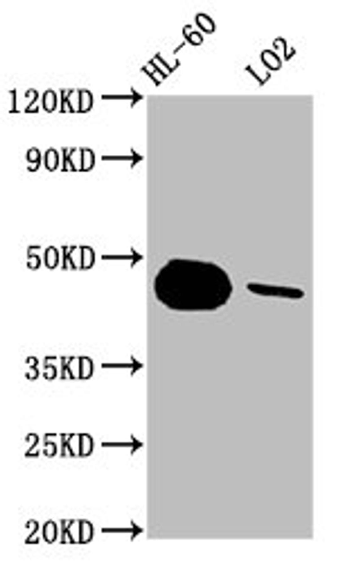 Western Blot. Positive WB detected in: HL-60 whole cell lysate, LO2 whole cell lysate. All lanes: CASP9 antibody at 1.8μg/ml. Secondary. Goat polyclonal to rabbit IgG at 1/50000 dilution. Predicted band size: 47, 31, 18, 37 KDa. Observed band size: 47 KDa.