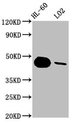 Western Blot. Positive WB detected in: HL-60 whole cell lysate, LO2 whole cell lysate. All lanes: CASP9 antibody at 1.8μg/ml. Secondary. Goat polyclonal to rabbit IgG at 1/50000 dilution. Predicted band size: 47, 31, 18, 37 KDa. Observed band size: 47 KDa.