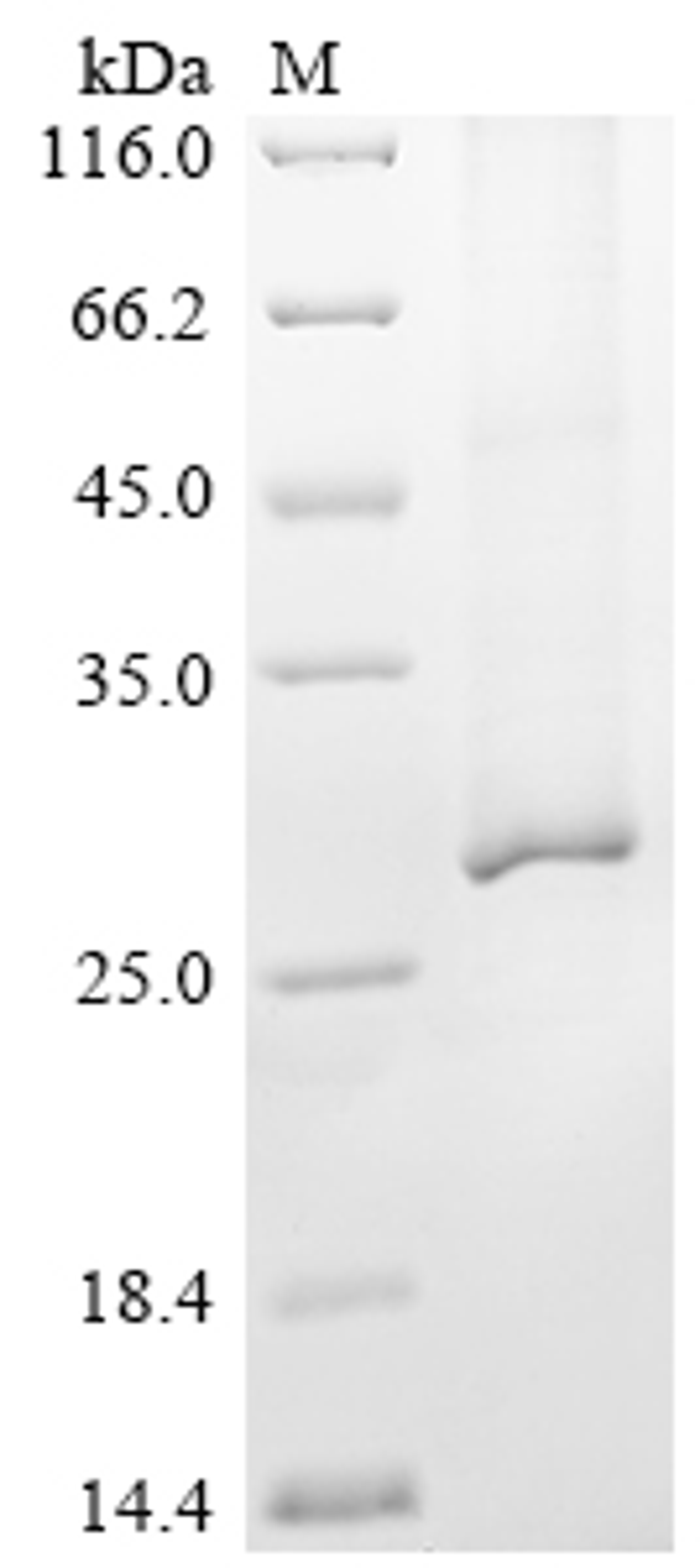 (Tris-Glycine gel) Discontinuous SDS-PAGE (reduced) with 5% enrichment gel and 15% separation gel.