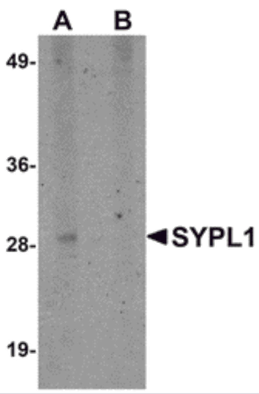 Western blot analysis of SYPL1 in human brain tissue lysate with SYPL1 antibody at 1 μg/mL in (A) the absence and (B) the presence of blocking peptide.