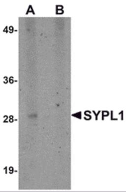 Western blot analysis of SYPL1 in human brain tissue lysate with SYPL1 antibody at 1 μg/mL in (A) the absence and (B) the presence of blocking peptide.