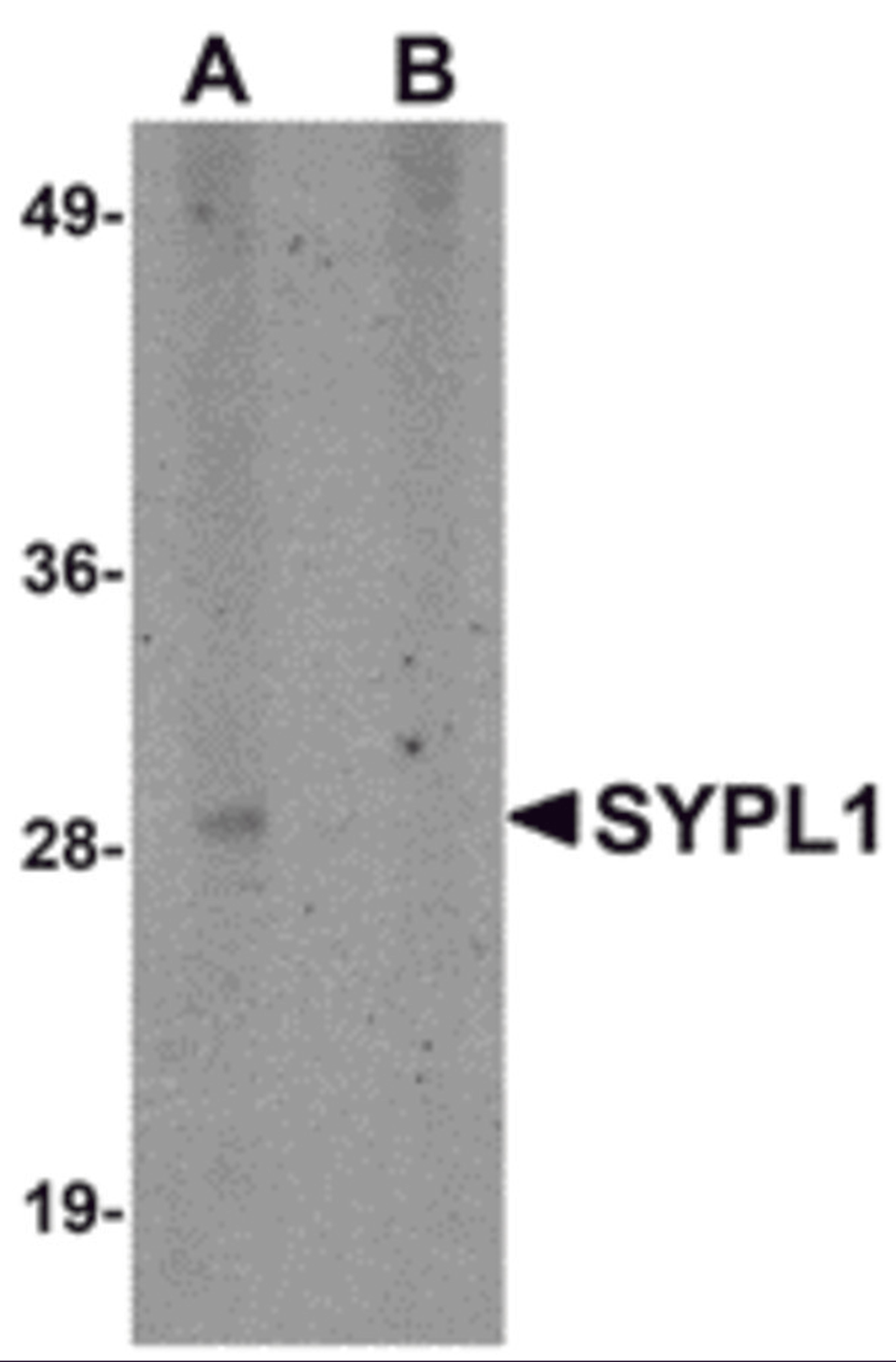 Western blot analysis of SYPL1 in human brain tissue lysate with SYPL1 antibody at 1 μg/mL in (A) the absence and (B) the presence of blocking peptide.