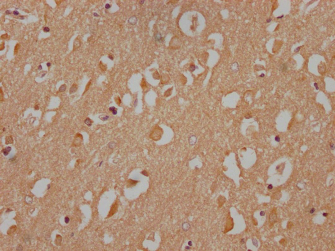IHC image of CSB-PA890690NA172nphHU diluted at 1:100 and staining in paraffin-embedded human brain tissue performed on a Leica BondTM system. After dewaxing and hydration, antigen retrieval was mediated by high pressure in a citrate buffer (pH 6.0). Section was blocked with 10% normal goat serum 30min at RT. Then primary antibody (1% BSA) was incubated at 4°C overnight. The primary is detected by a Goat anti-rabbit IgG labeled by HRP and visualized using 0.05% DAB.