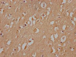 IHC image of CSB-PA890690NA172nphHU diluted at 1:100 and staining in paraffin-embedded human brain tissue performed on a Leica BondTM system. After dewaxing and hydration, antigen retrieval was mediated by high pressure in a citrate buffer (pH 6.0). Section was blocked with 10% normal goat serum 30min at RT. Then primary antibody (1% BSA) was incubated at 4°C overnight. The primary is detected by a Goat anti-rabbit IgG labeled by HRP and visualized using 0.05% DAB.