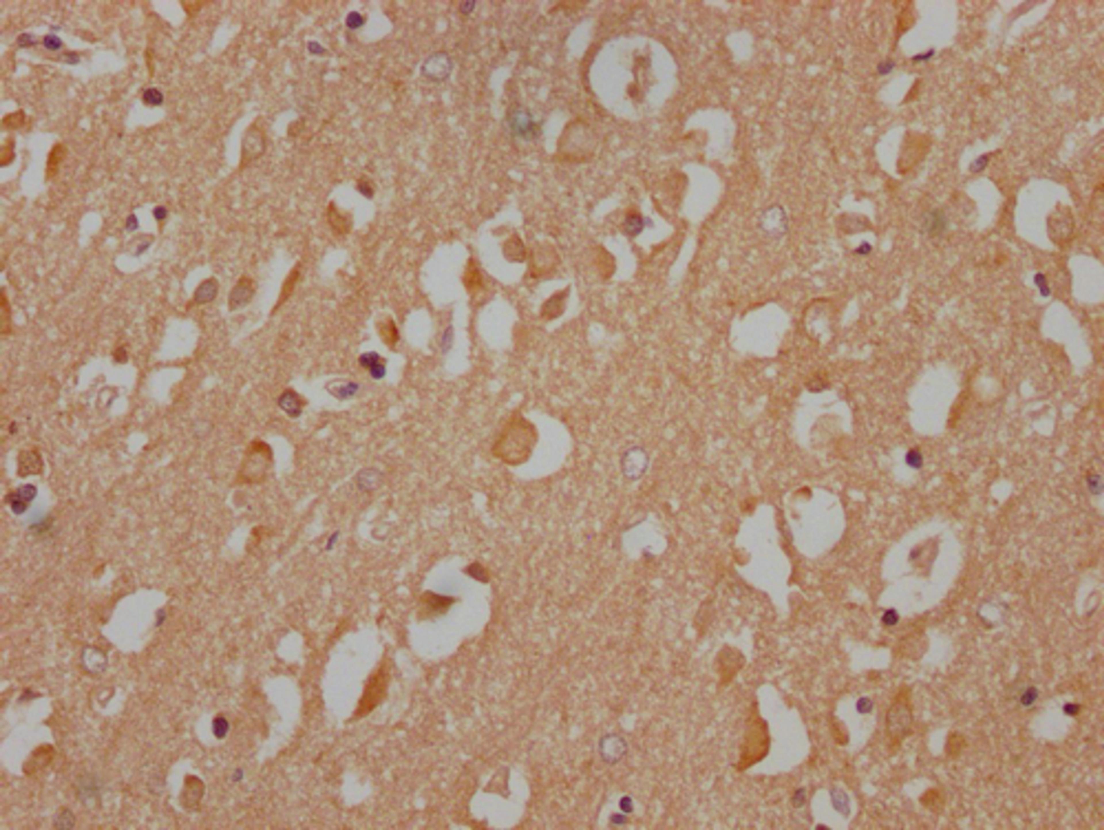 IHC image of CSB-PA890690NA172nphHU diluted at 1:100 and staining in paraffin-embedded human brain tissue performed on a Leica BondTM system. After dewaxing and hydration, antigen retrieval was mediated by high pressure in a citrate buffer (pH 6.0). Section was blocked with 10% normal goat serum 30min at RT. Then primary antibody (1% BSA) was incubated at 4°C overnight. The primary is detected by a Goat anti-rabbit IgG labeled by HRP and visualized using 0.05% DAB.