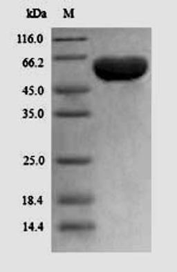 (Tris-Glycine gel) Discontinuous SDS-PAGE (reduced) with 5% enrichment gel and 15% separation gel.