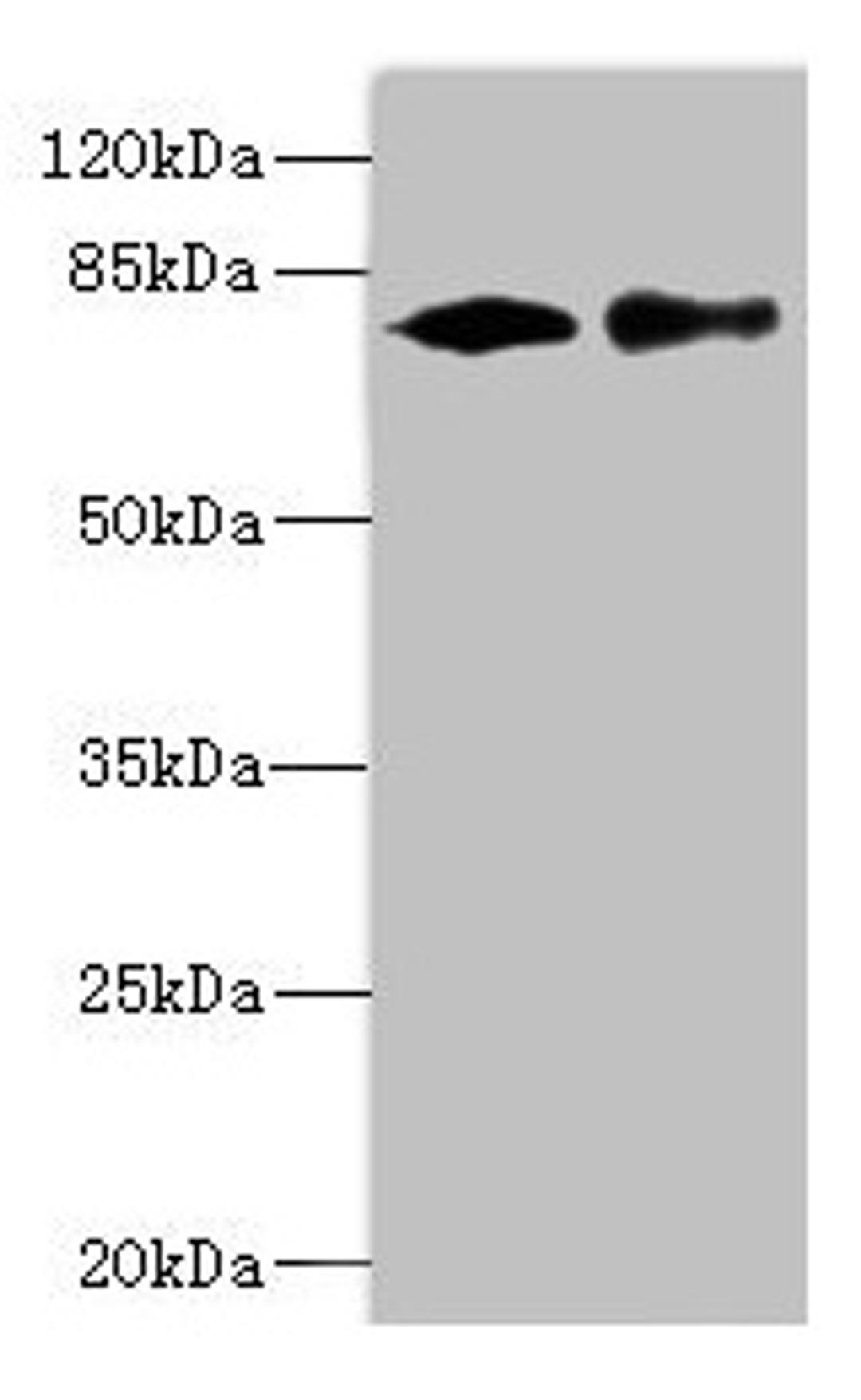 Western blot. All lanes: CALCOCO1 antibody at 1.61µg/ml. Lane 1: 293T whole cell lysate. Lane 2: MCF-7 whole cell lysate. Secondary. Goat polyclonal to rabbit IgG at 1/10000 dilution. Predicted band size: 78, 71, 68 kDa. Observed band size: 78 kDa