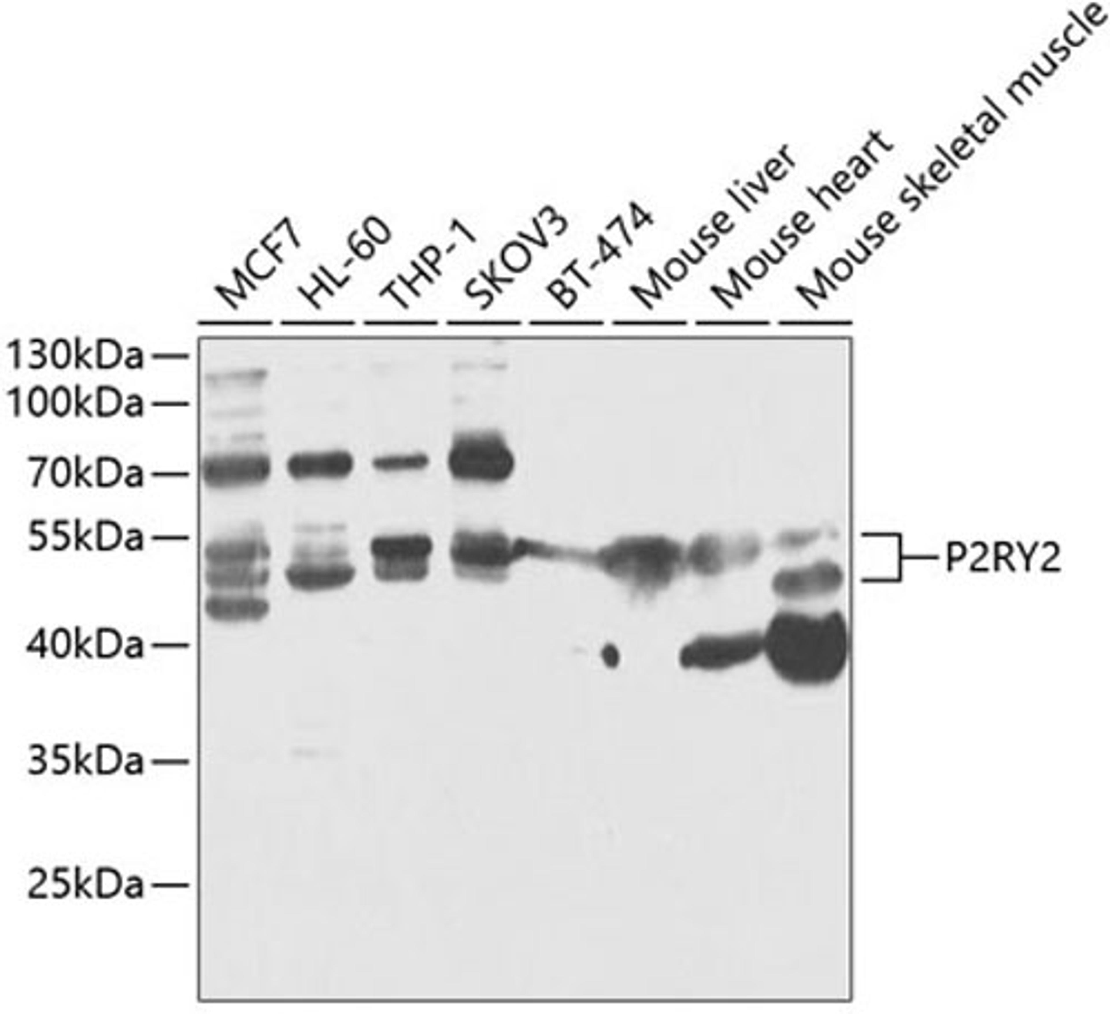 Western blot - P2RY2 antibody (A13923)