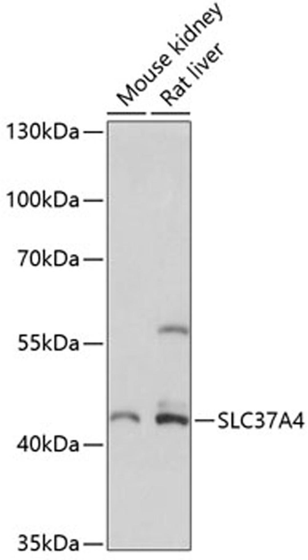 Western blot - SLC37A4 antibody (A14564)